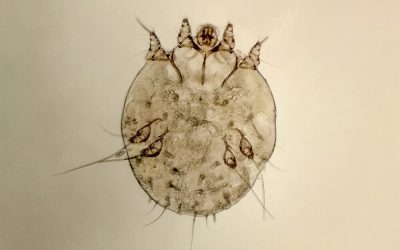 Scabies Research Highlights